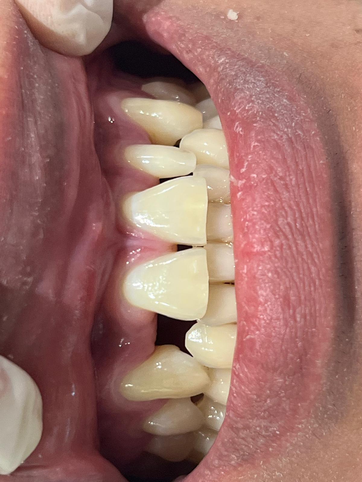 ECE Dental Patient Transformation